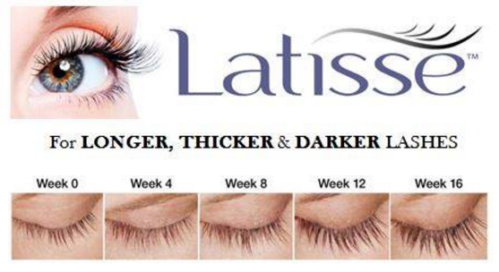 Latisse Eye Lashes